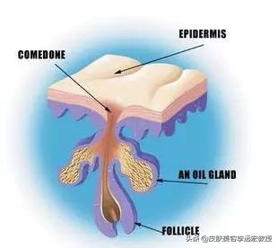 毛孔堵塞是病吗,皮肤暗沉毛孔堵塞怎么办