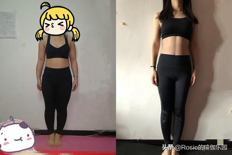 小腿粗外翻怎么穿短裙,穿高跟鞋导致腿粗怎么减