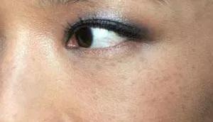 祛色斑的小窍门,色斑严重学会这几招省钱又有效