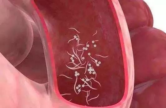 9岁男孩屁股又疼又痒,到医院一看,10多条虫子从肛门爬出