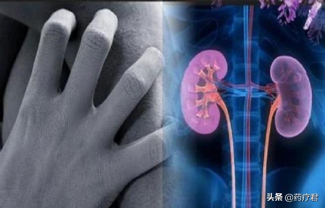 肾损伤服用格列本脲伤肾吗,药物导致肾损伤吃什么护肾药