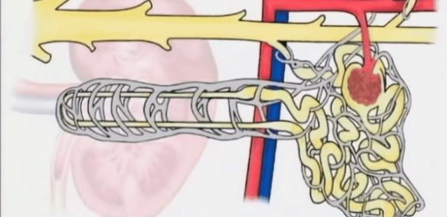 正常人的尿液里有白色絮状物吗,正常人的尿液中有葡萄糖吗