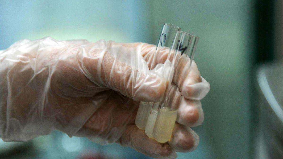 精子出现小蝌蚪咋回事,男性的精子呈褐色正常吗