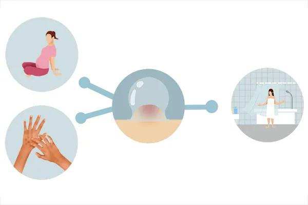 拔火罐的印子怎样快速去掉,拔火罐的印子怎样快速消除