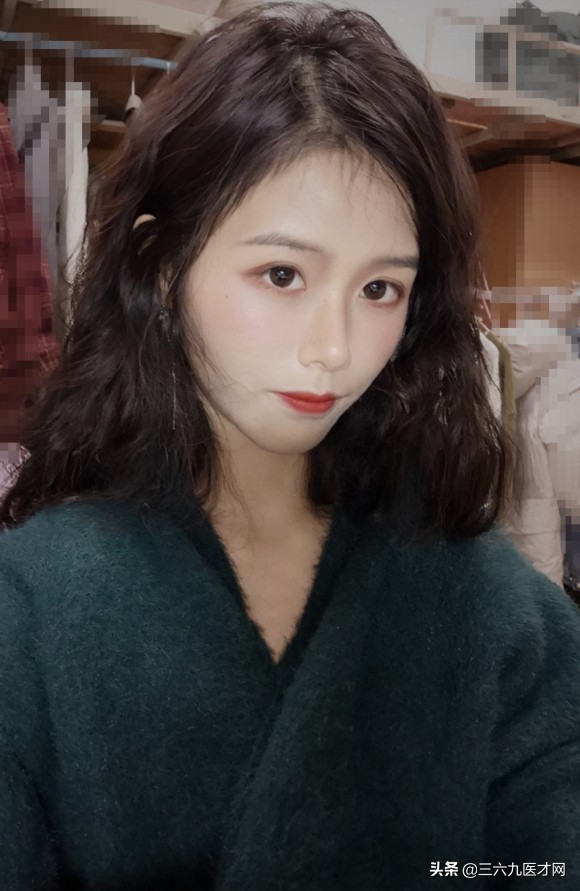 龅牙矫正成功的图片对比,2周岁龅牙可以矫正吗