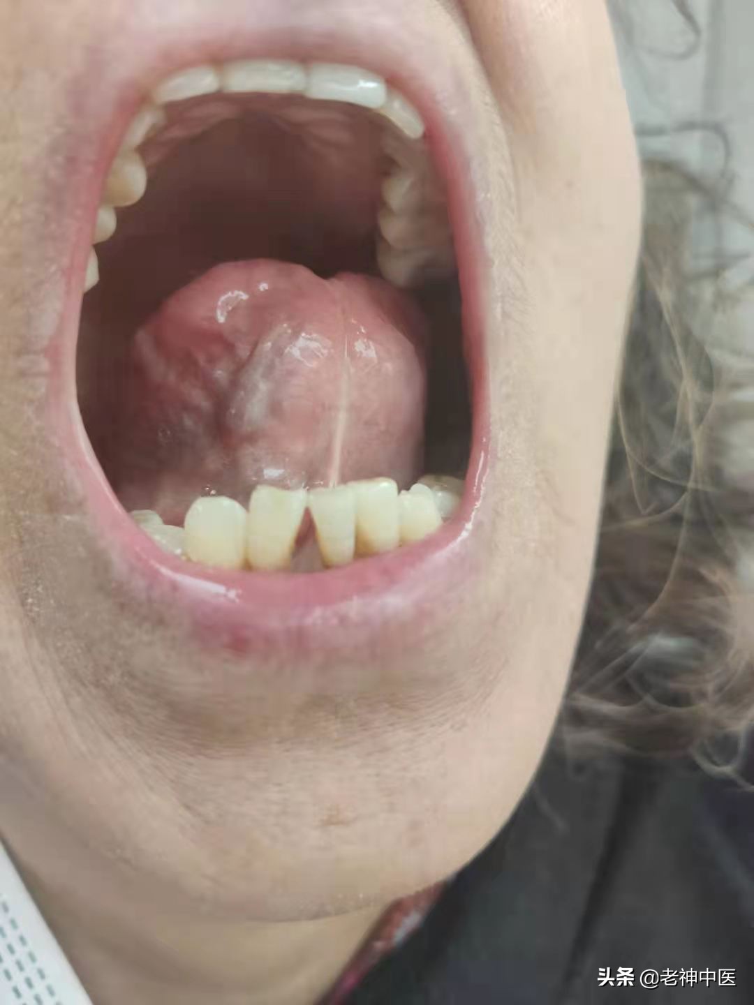 冠心病胸绞痛,冠心病肩背疼吃什么药