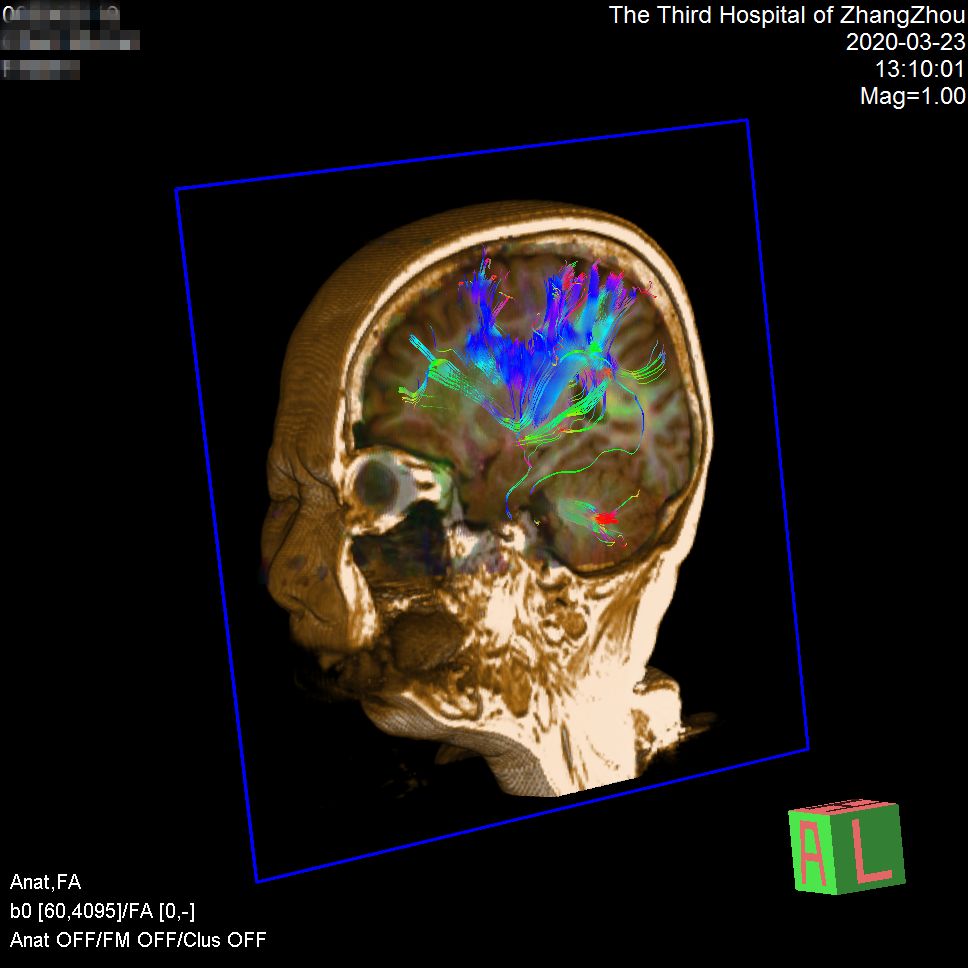 漳州市第三医院预约做磁共振,3.0t核磁共振广东哪里可以做
