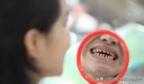 烤瓷牙做过后最好的修复方法,烤瓷牙里面的真牙烂了怎么办