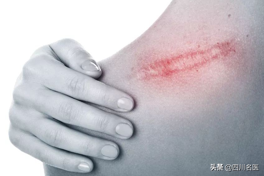 一张创可贴差点毁掉孩子整只手,一张创可贴就可以解决的事