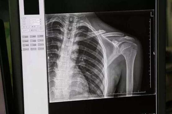 交通事故住院注意哪些事项,交通事故住院报销注意事项