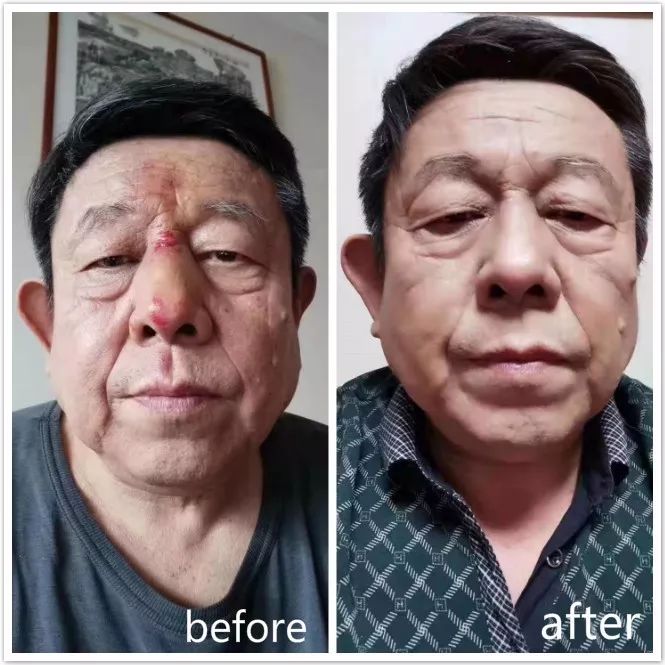 紫檀膏对皮肤有什么好处,紫檀膏治什么病