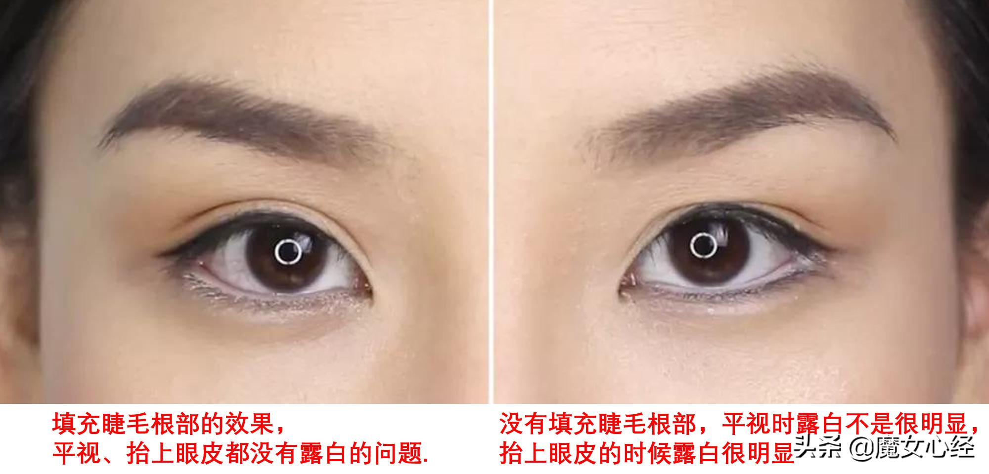 画内眼线和外眼线哪个危害更大,为什么医生不建议画内眼线