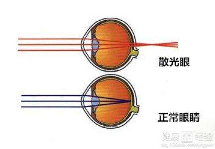 散光看东西有虚影是怎么回事,预防眼睛疲劳的最好方法