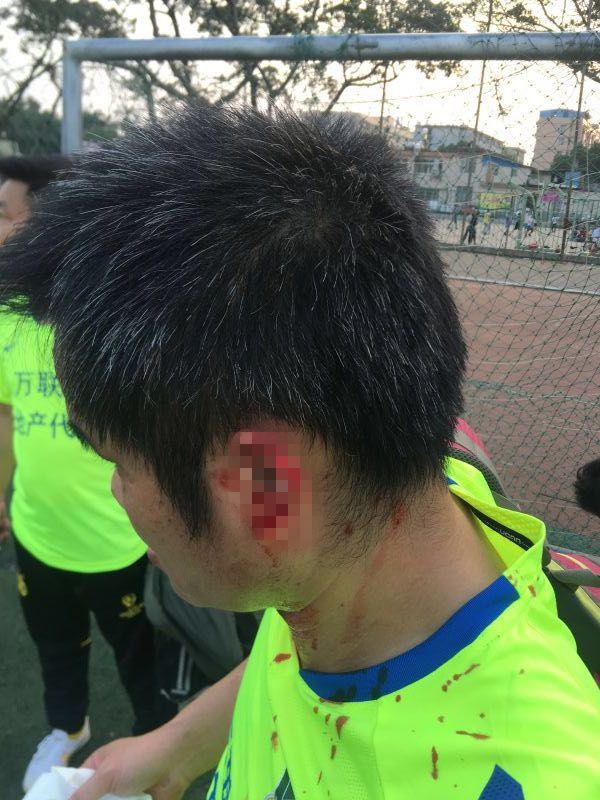 中国足球乱象真实视频,盘点中国足球的现实现象飞盘