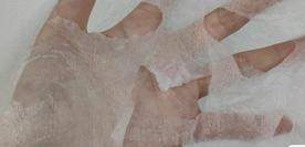 解决闭口最佳方法不复发,如何去闭口最有效方法