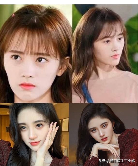 鞠婧祎换头的正确方法,鞠婧祎是怎么从扁头变成圆头的