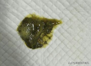 宝宝拉绿便不怎么长肉喝什么奶粉,宝宝拉绿色便便是妈妈吃凉的了吗