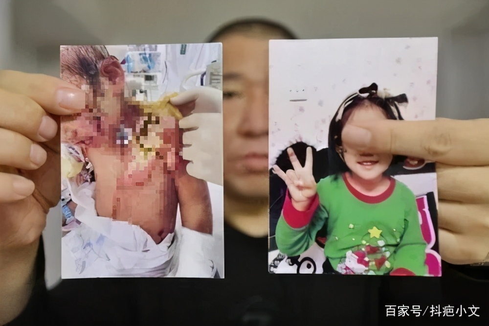 小孩经常受伤怎么办,孩子不小心受伤情况有哪些
