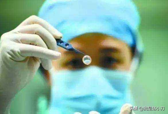 年轻人做白内障手术好吗,年轻人做白内障手术的前途