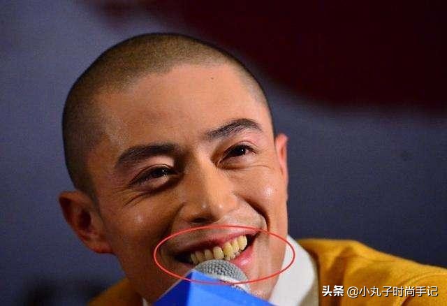 李沁牙膏真的有效果吗,李沁的黄牙变白了