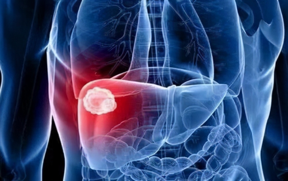 抗乙肝病毒效果好为什么还是肝癌,已经在吃乙肝抗病毒药是否预防hiv