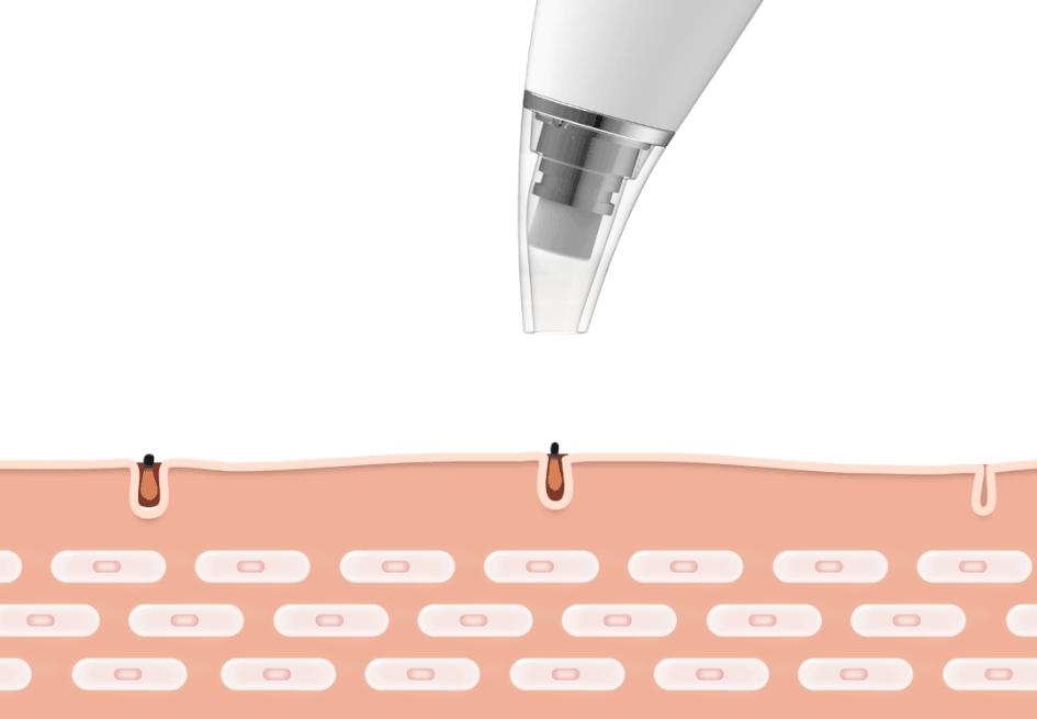 小米榨干行业*力暴**！149元搅局1200元美容市场，飞利浦：怎么办？