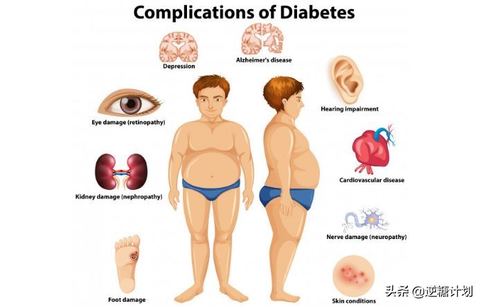 低碳饮食引起痛风能恢复吗,低碳饮食尿酸升高会痛风么