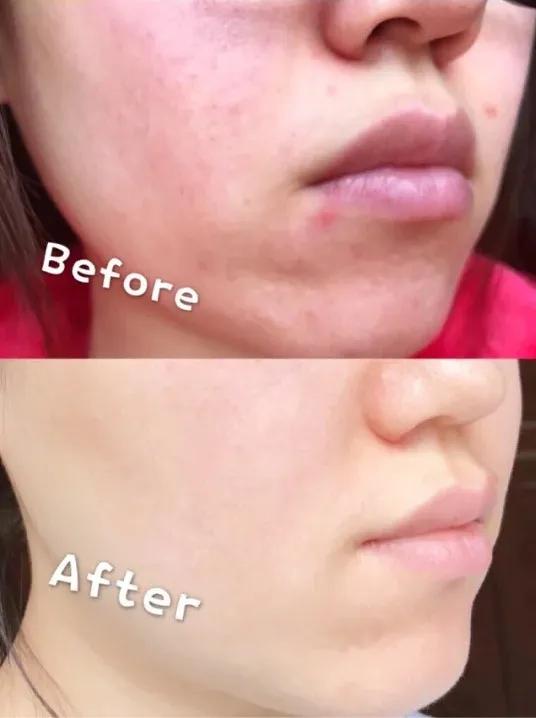 「好评反馈来啦」疯狂打call，实力表白｜为什么*干粉冻**这么受欢迎