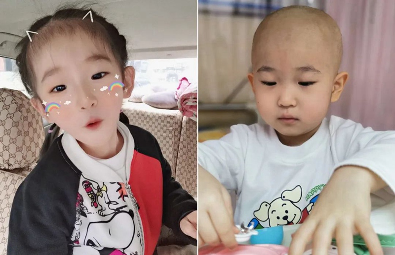 女儿头上长虱子妈妈给剃光了,女童冬天头上有虱子怎么办