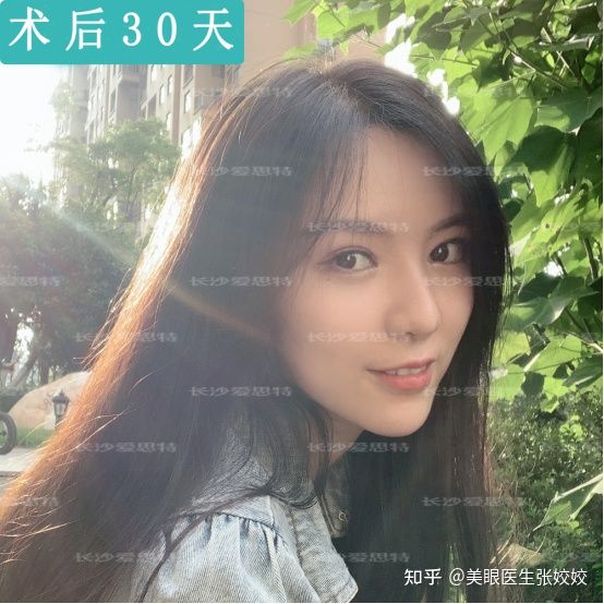 为什么割的双眼皮会显得假,为什么有的双眼皮做出来特别假