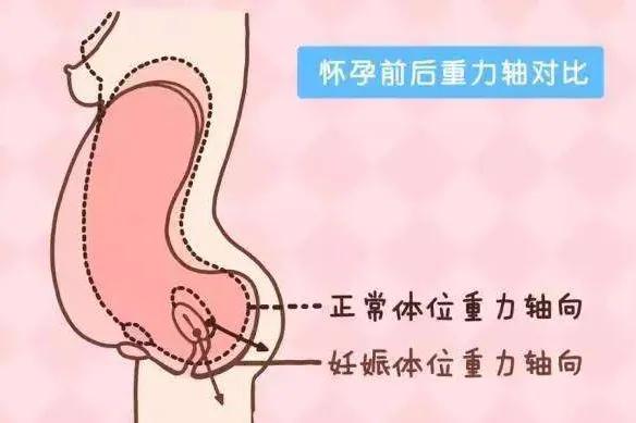 孕产课堂视频教程,产后子宫脱垂注意事项