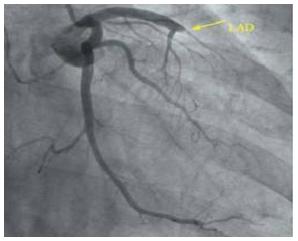 心脏彩超检查您了解吗,心脏彩超查的是胸吗