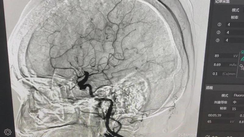 dsa鍖荤敓鎷涜仒2021,dsa涓村簥鍩硅