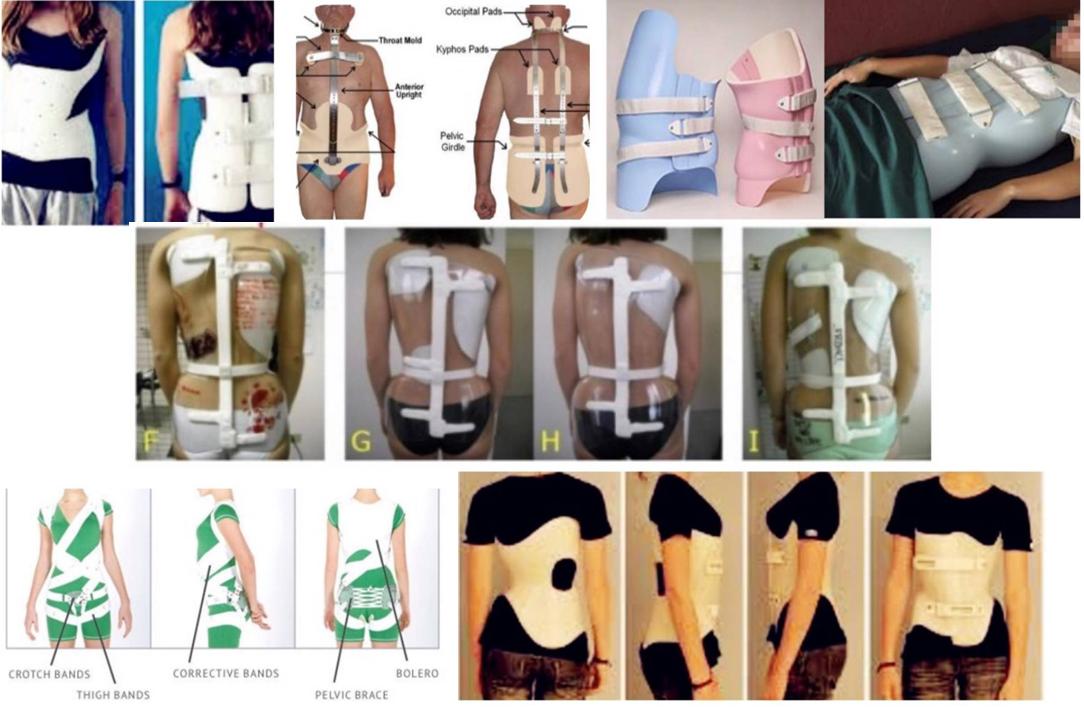 10岁孩子脊柱凸起是什么原因,10岁孩子后背脊柱突出图片