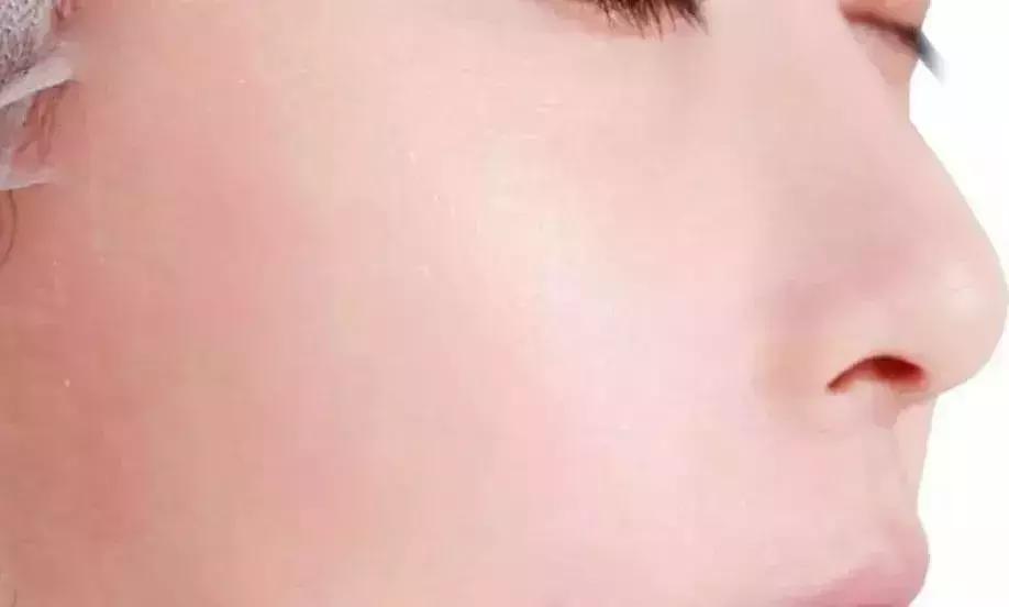 面膜怎么敷效果最好多久敷一次 (面膜要怎么敷才是正确的)