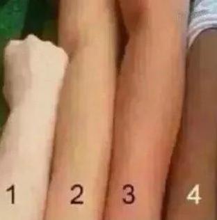 夏天晒黑怎么恢复美白,夏天晒黑了怎么快速变白