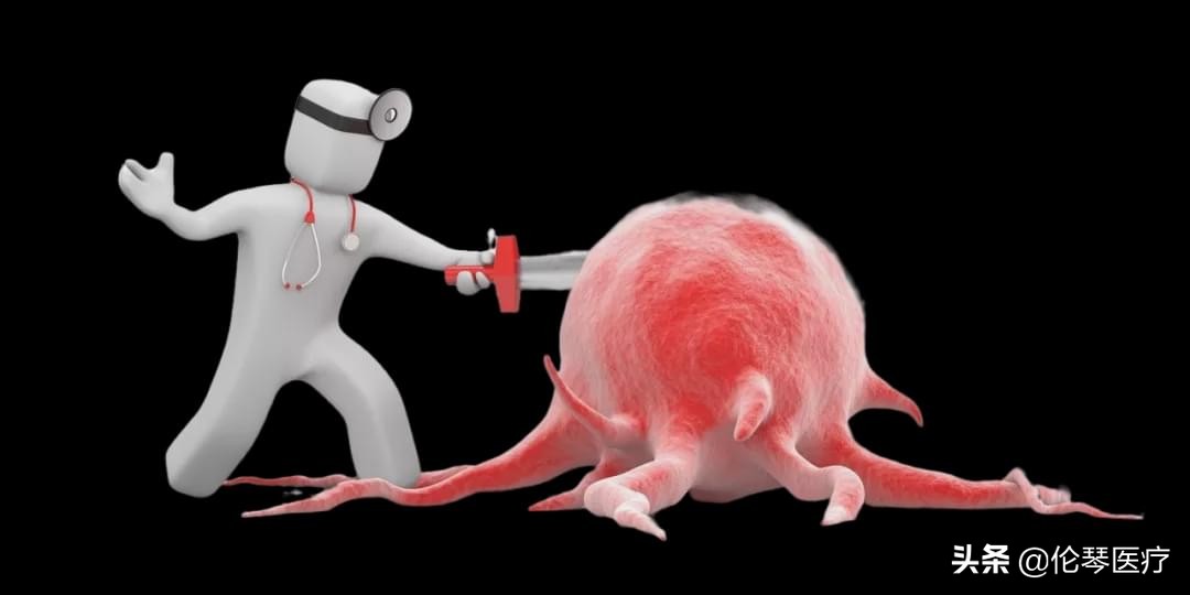 2022年恶性肿瘤筛查与预防指南,常见恶性肿瘤的预防和筛检