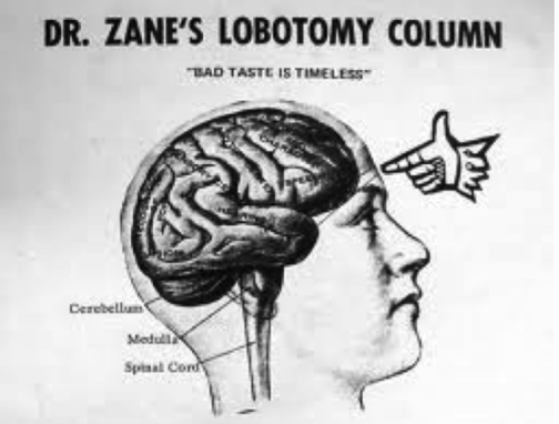 肯尼迪家族“隐身女孩”:美丽而有智力缺陷,23岁接受“脑切除”