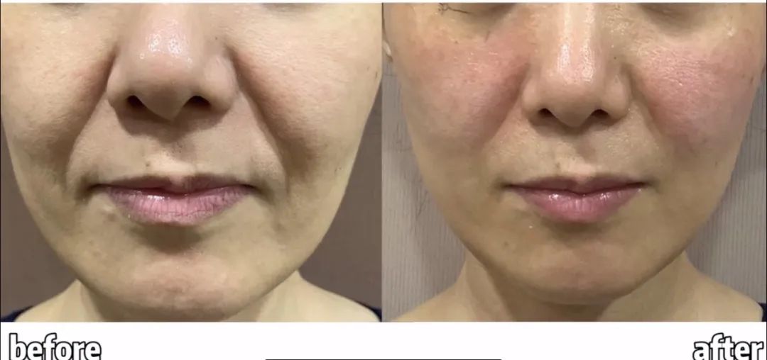 医美项目爆款,医美贴牌创始人