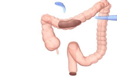 儿童便秘拉不出粑粑怎么办,孩子便秘拉不动