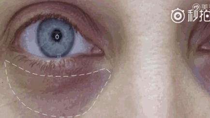 久治不消的黑眼圈,一支口红就能搞定