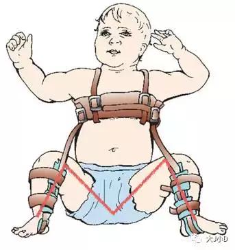 半岁宝宝适合用什么样的腰凳,腰凳宝宝多大可以坐