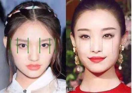 开眼角的魅力有多强,开眼角让你美丽蜕变