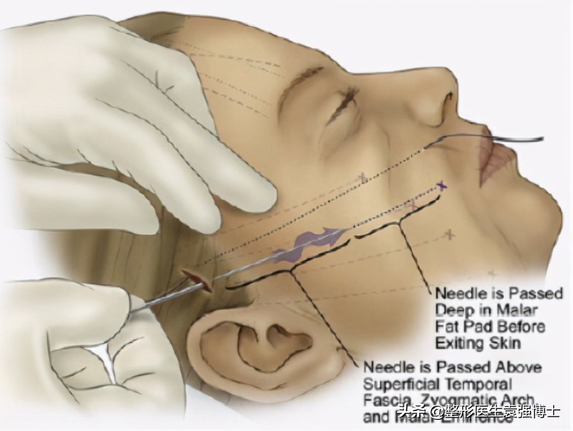 50岁抗褶皱紧致精华,50岁用什么抗衰紧致面霜