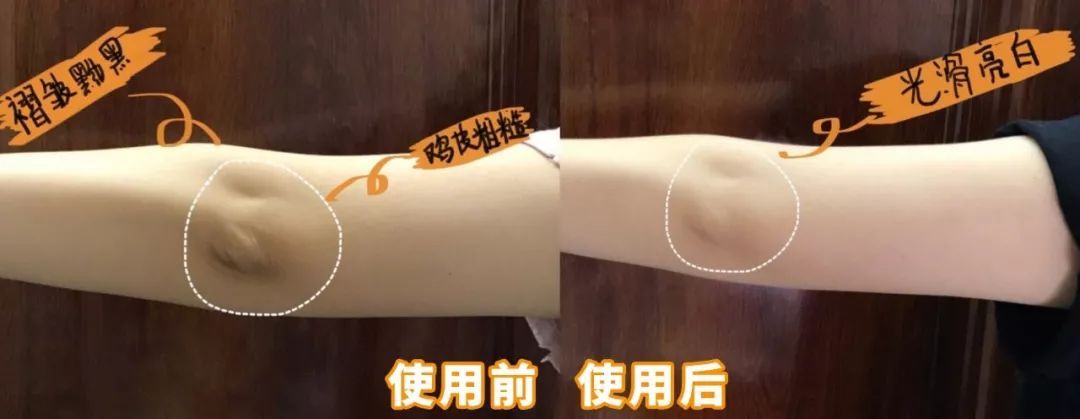 黑皮克星上线！澳洲销量第一羊奶皂，马云点赞，李佳琦直播打call