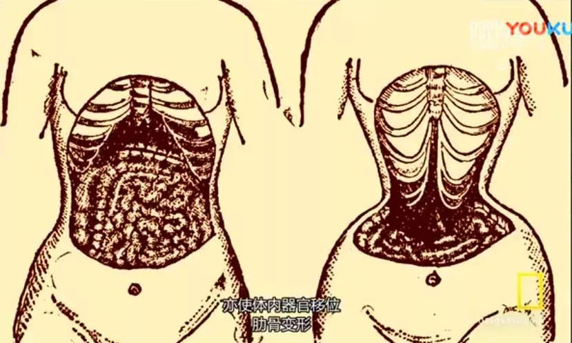 汕头人民一*工罢**，全世界都要穿不上内衣了？