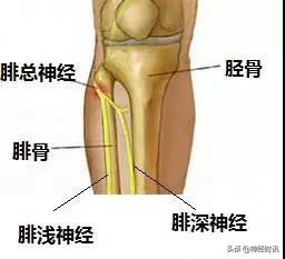病理脚麻的最快恢复方法,脚麻诊断思路
