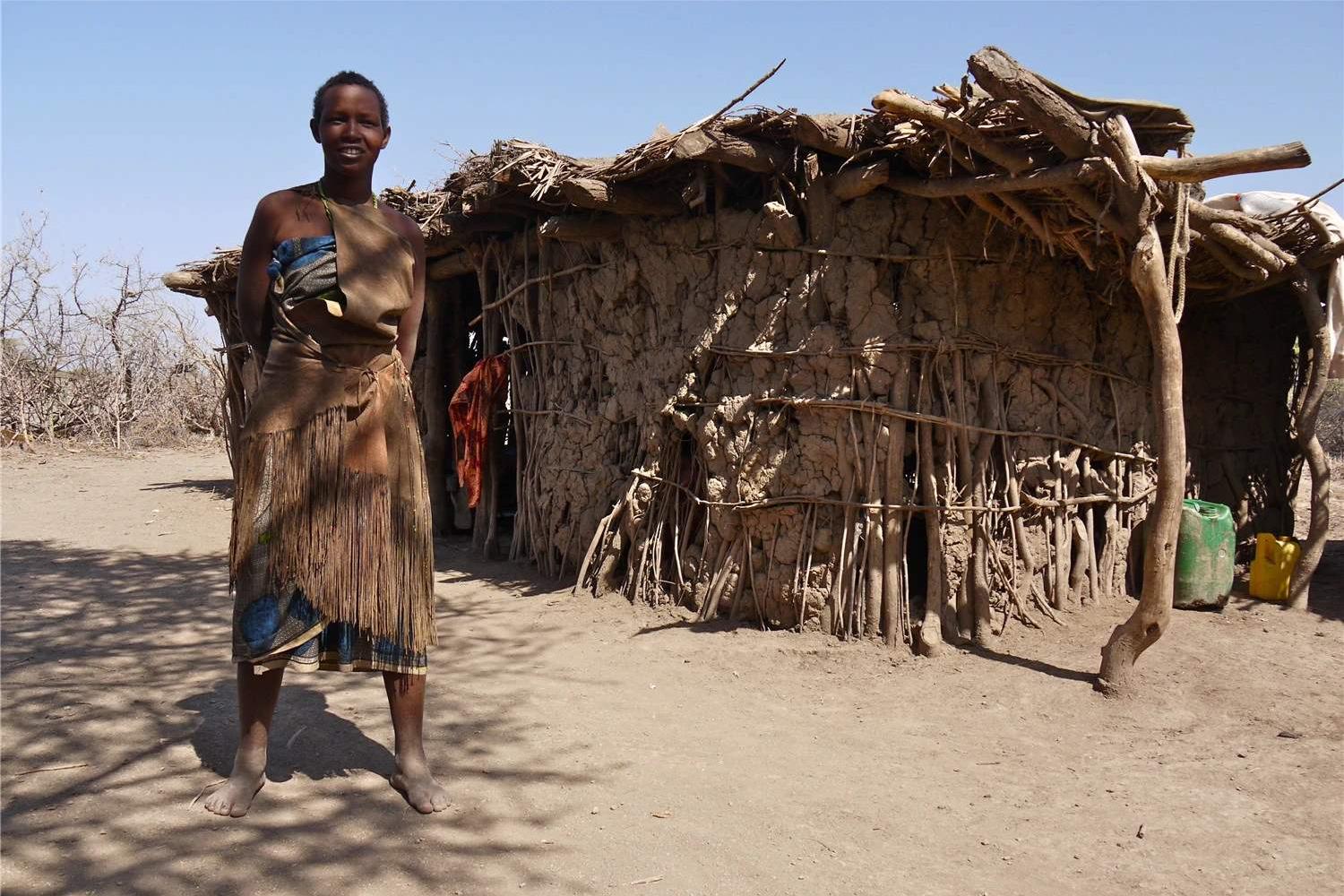 有一种孕妇叫非洲妈妈，分娩姿势像“母鸡下蛋”，网友：不难受？