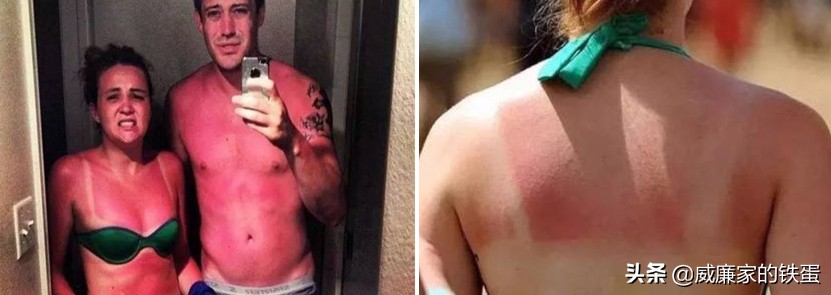 你！不准黑！沙滩救生员用它，炙烤8小时0晒伤！风靡澳洲百年