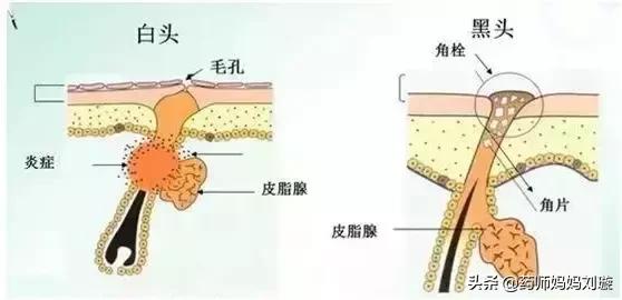 疮疡病的克星,清创宝典